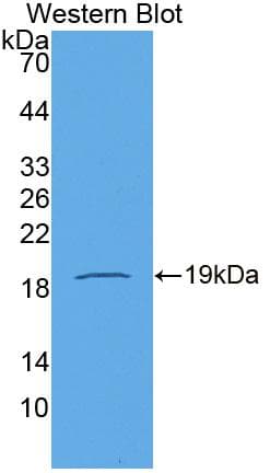 CDH2 / N Cadherin Antibody (Cy3)