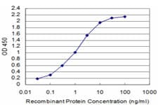 IHC-plus™ SIX4 Antibody (clone 3B8)