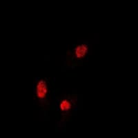 IHC-plus™ Polyclonal Rabbit anti-Human SOX5 Antibody (IHC, IF, WB)