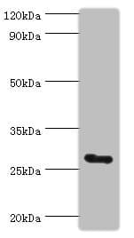 C14orf166 Antibody (aa1-244)