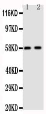 CYP19 / Aromatase Antibody (aa485-503)