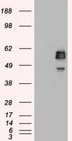 Monoclonal Mouse anti-Human SSB / La Antibody (clone OTI3F11, IHC, IF, WB)