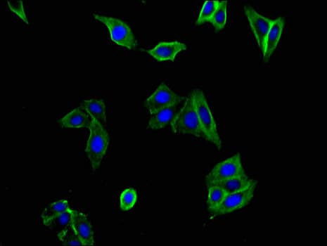 FLT1 / VEGFR1 Antibody
