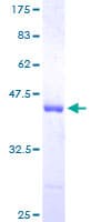Human PFN1 / Profilin 1 Protein (Recombinant GST)