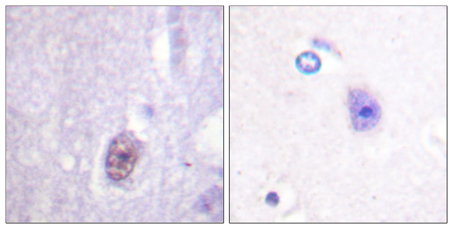 SP1 Antibody (phospho-Thr453)