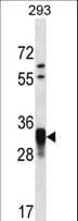 Polyclonal Rabbit anti-Human CCNO / UNG2 Antibody (aa1-30, WB)