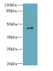 CASQ1 / Calsequestrin 1 Antibody