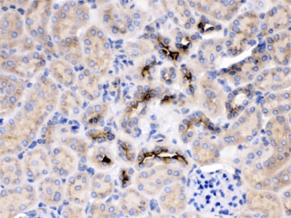 GNB1 Antibody