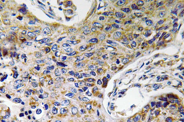 Polyclonal Rabbit anti-Human ATP5J2 / F1Fo-ATPase Antibody (aa21-70, IHC)