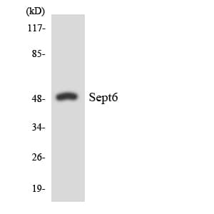 IHC-plus™ Polyclonal Rabbit anti-Human SEPT6 / Septin 6 Antibody (aa208-257, IHC, WB)