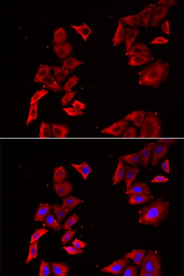 MAP2K5 / MEK5 Antibody
