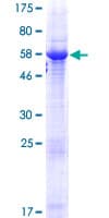 Human HORMAD2 Protein (Recombinant GST)