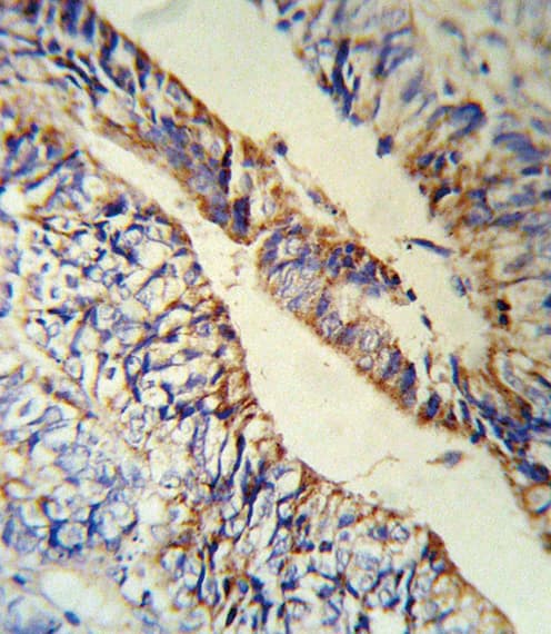 PCSK9 Antibody (aa479-508)