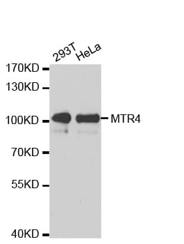 IHC-plus™ Polyclonal Rabbit anti-Human SKIV2L2 Antibody (IHC, WB)