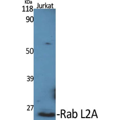 RABL2A Antibody (170-250 aa, C-terminal)