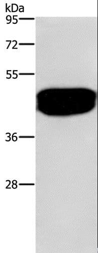 SDCCAG3 Antibody