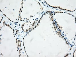 USP5 Antibody (clone OTI2F5)