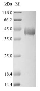 Rabbit TPM1 / Tropomyosin Protein (Recombinant 10His, N-terminus + Myc, C-terminus)