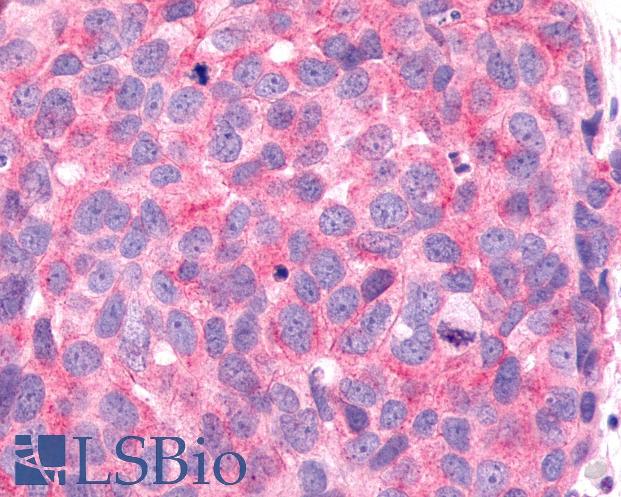 PathPlus™ Polyclonal Rabbit anti-Human FZD6 / Frizzled 6 Antibody (N-Terminus, IHC)