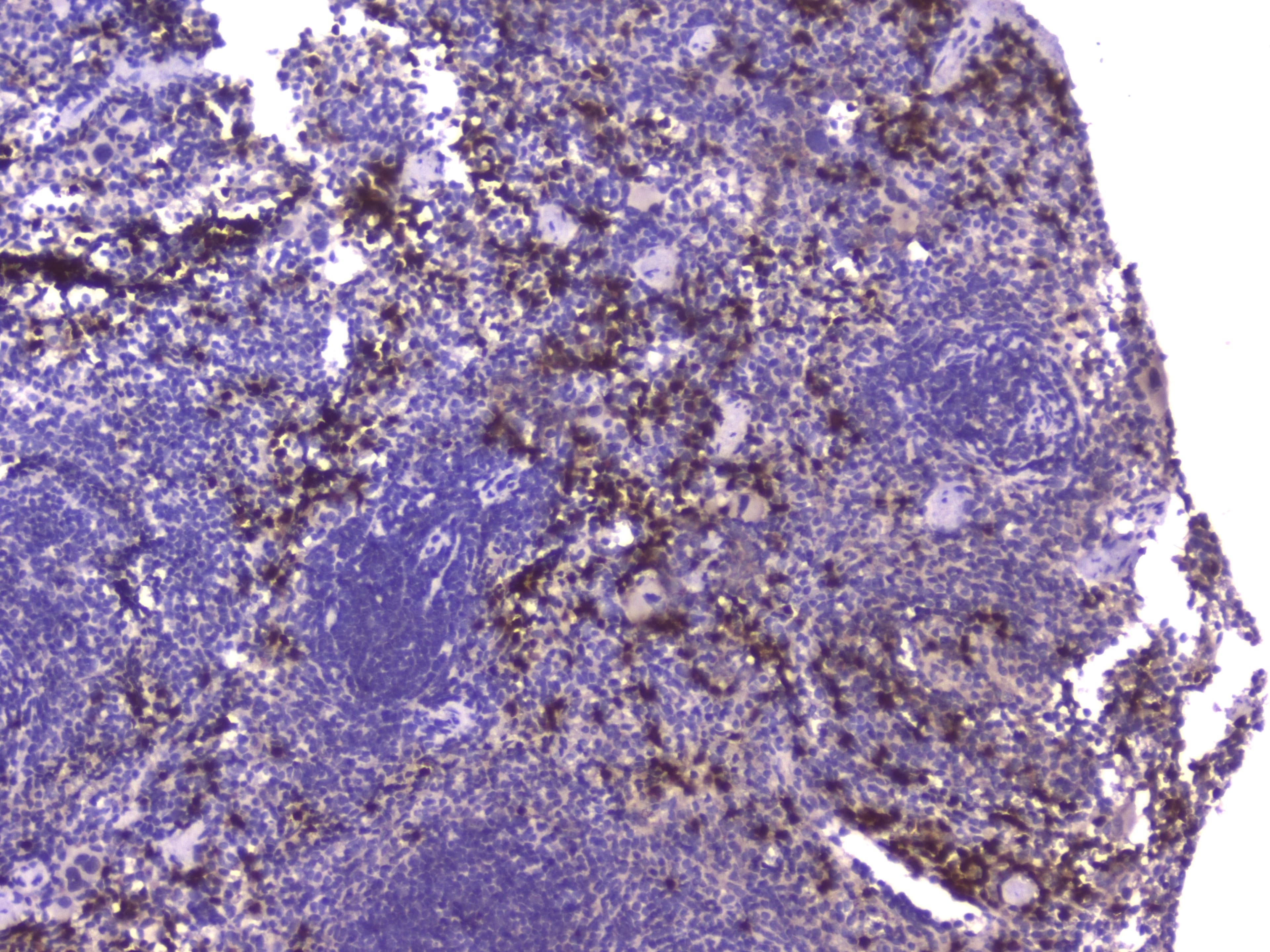 CCL8 / MCP2 Antibody