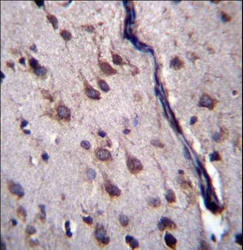 PPP1R27 / DYSFIP1 Antibody (aa1-30)