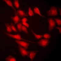 Polyclonal Rabbit anti-Human KMT2E / MLL5 Antibody (IF, WB)