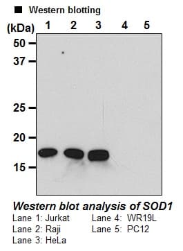 SOD1 / Cu-Zn SOD Antibody (clone 1G2)