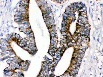 MAOA / Monoamine Oxidase Antibody