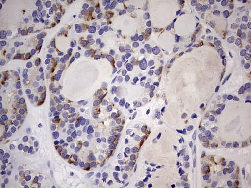 TRIM27 Antibody (clone OTI3B12)