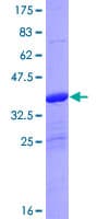 Human EIF4EBP3 Protein (Recombinant GST)