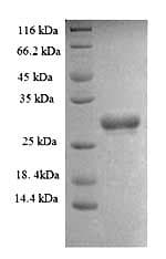 Human SMARCC1 / SWI3 Protein (Recombinant 6His, N-terminus)