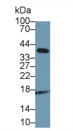 ADM / Adrenomedullin Antibody (aa31-187, APC)