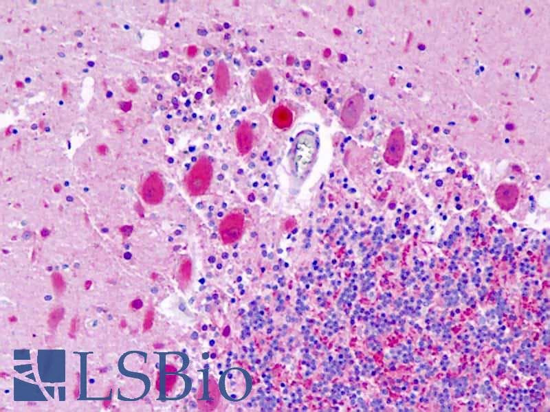IHC-plus™ UCHL1 / PGP9.5 Antibody (aa187-214)