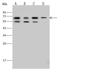 IMP-3 / IGF2BP3 Antibody