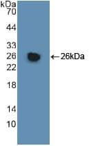 GSTM1 Antibody (aa1-218)