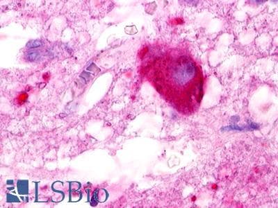 PathPlus™ Polyclonal Rabbit anti-Human LPAR5 / GPR92 Antibody (C-Terminus, IHC)