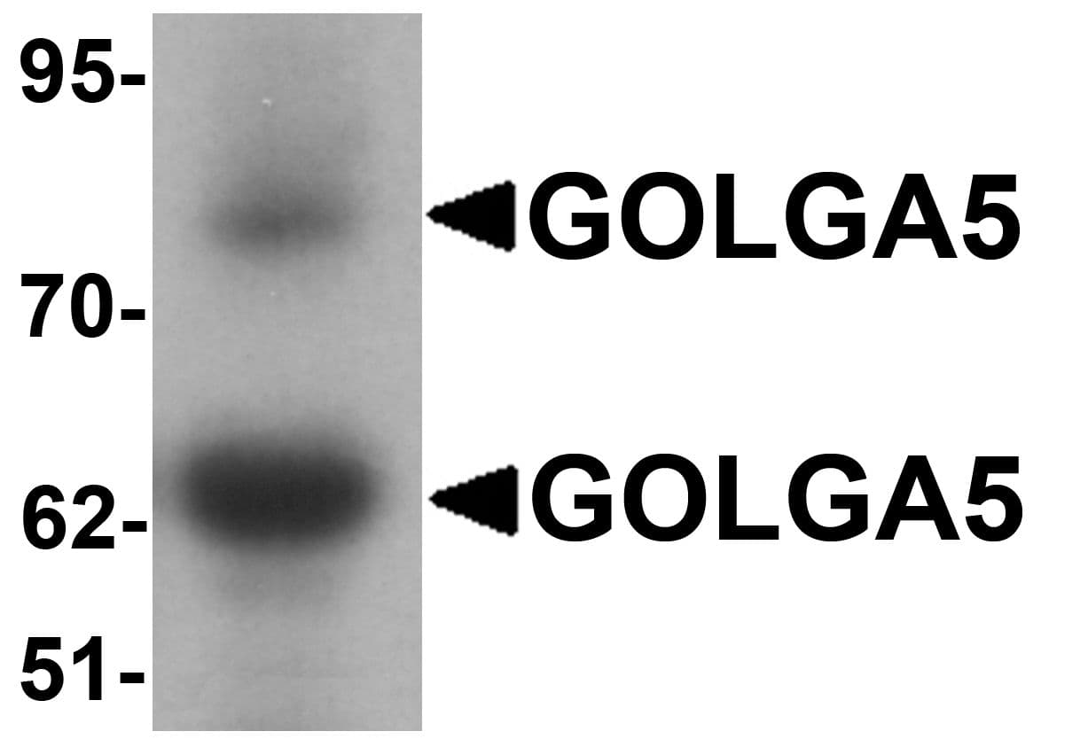 IHC-plus™ GOLGA5 Antibody
