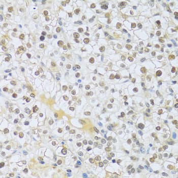 Polyclonal Rabbit anti-Human MAPK3 / ERK1 Antibody (IHC, IF, WB)
