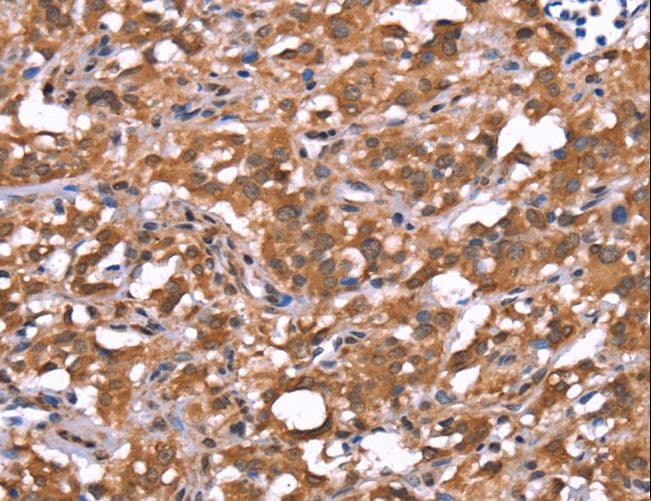 FAM123B / WTX Antibody