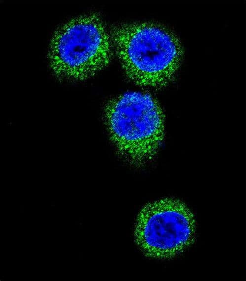 FGFR2 / FGF Receptor 2 Antibody (aa794-821)