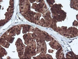 DSTN / Destrin Antibody (clone OTI1G8, Carrier-free)