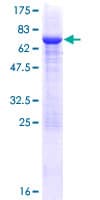 Human PELI2 / Pellino 2 Protein (Recombinant GST)