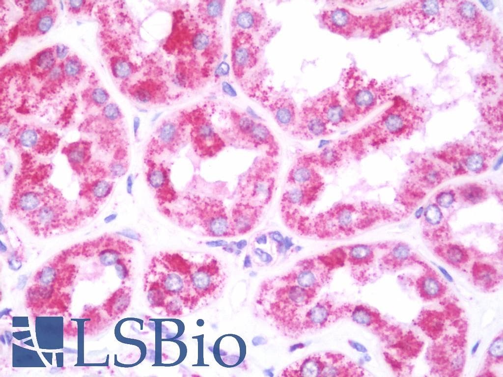 IHC-plus™ LAMB3 / Laminin Beta 3 Antibody (aa644-960)