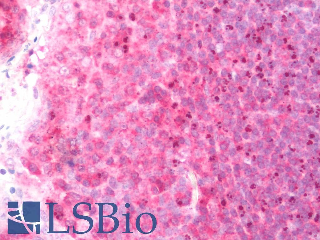 IHC-plus™ Polyclonal Rabbit anti-Human ODZ3 Antibody (IHC, IF, WB)