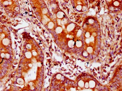 Polyclonal Rabbit anti-Human CDAN1 Antibody (IHC, IF)