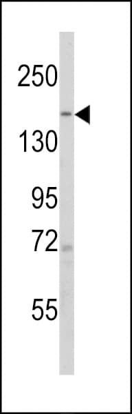 Polyclonal Rabbit anti-Human SCOP / PHLPP Antibody (aa531-560, WB)
