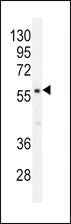 Polyclonal Rabbit anti-Human PDE1B Antibody (aa473-500, IHC, WB)