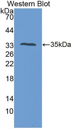 PTPRS Antibody (aa77-374, Cy3)