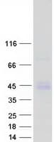 Human PDGF-AA Protein (Recombinant Myc-DDK (Flag))