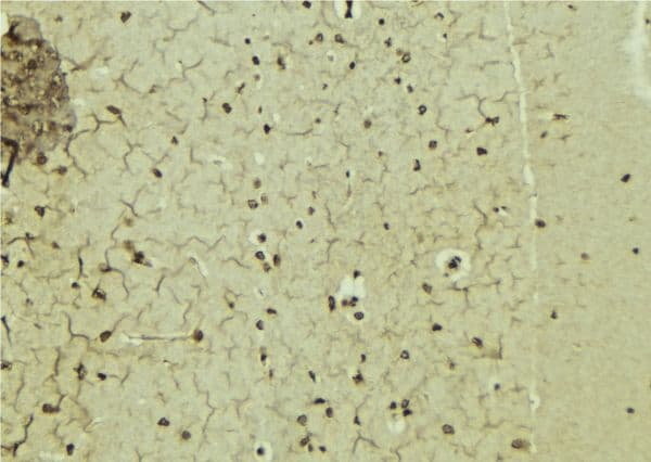 NR0B1 / DAX1 Antibody